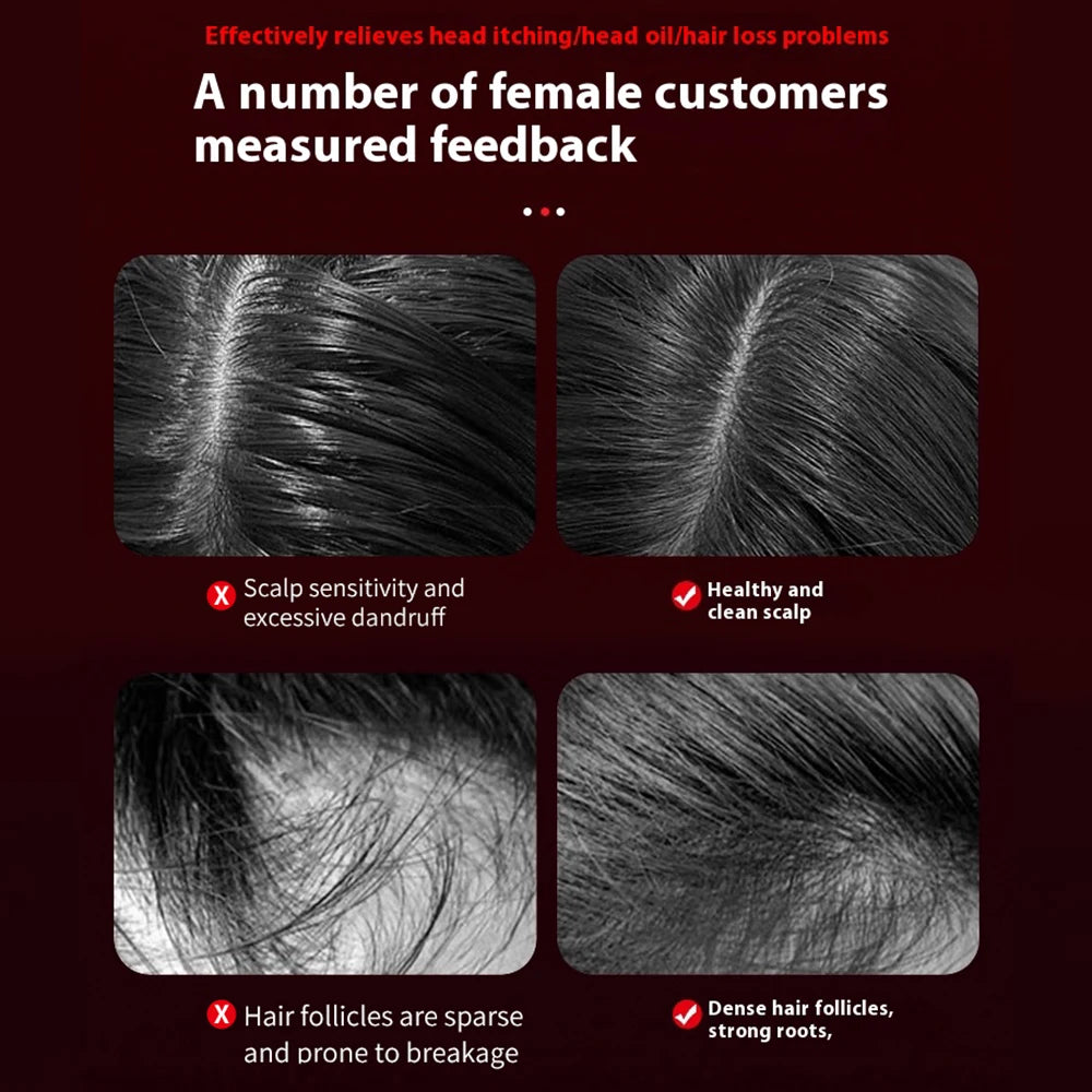 Infrared Scalp Massage Comb with Micro-Current Therapy | Hair Growth & Root Repair