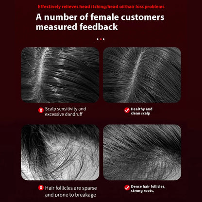 Infrared Scalp Massage Comb with Micro-Current Therapy | Hair Growth &amp; Root Repair